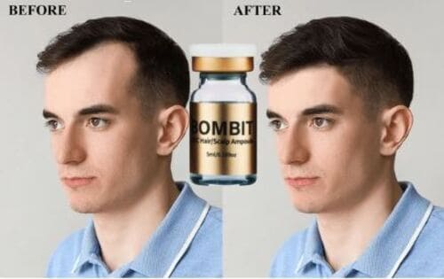 serum-moc-toc-bombit-hsc-ampoule-gia-bao-nhieu-va-mua-o-dau-uy-tin1